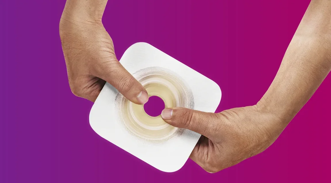 Convatec Moldable Technology skin barrier