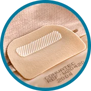 U4229787: closure.png