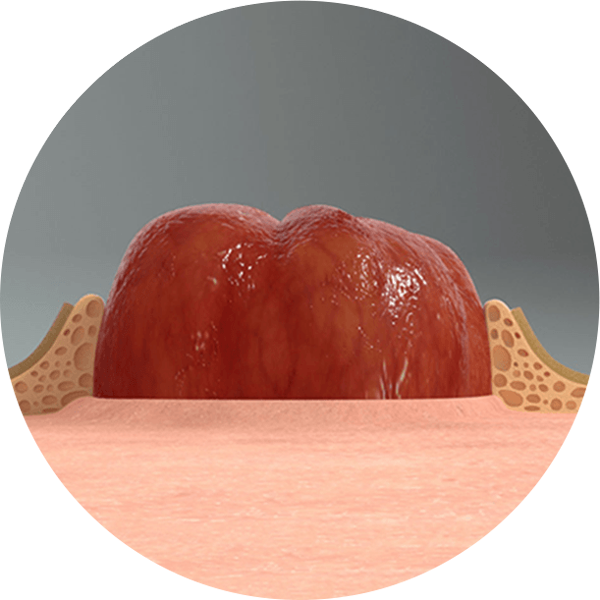 illustration of a skin barrier