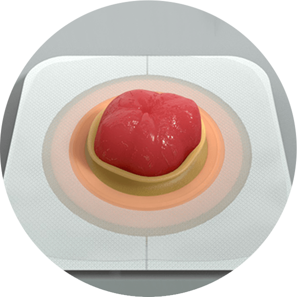 illustration of a skin barrier